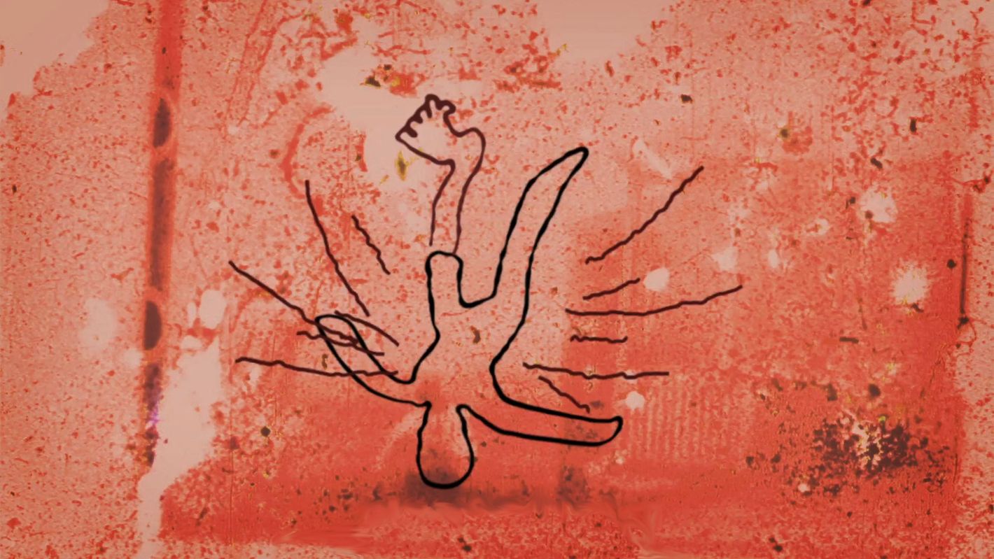 Un trou dans la jambe Court documentaire animé, 2016 Cinécoop